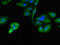 Serine/threonine-protein kinase tousled-like 2 antibody, LS-C679811, Lifespan Biosciences, Immunofluorescence image 