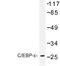 CCAAT Enhancer Binding Protein Epsilon antibody, LS-C176819, Lifespan Biosciences, Western Blot image 