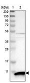 S100 Calcium Binding Protein P antibody, PA5-54006, Invitrogen Antibodies, Western Blot image 