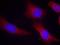Calcium/Calmodulin Dependent Protein Kinase II Alpha antibody, NB100-81830, Novus Biologicals, Immunocytochemistry image 