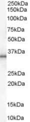 Uncoupling Protein 1 antibody, EB06994, Everest Biotech, Western Blot image 