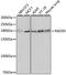 hRAD50 antibody, LS-C746738, Lifespan Biosciences, Western Blot image 