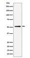 Nucleoporin 50 antibody, M06152, Boster Biological Technology, Western Blot image 