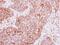 Insulin Like Growth Factor 2 MRNA Binding Protein 2 antibody, PA5-29869, Invitrogen Antibodies, Immunohistochemistry paraffin image 