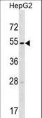 Transmembrane Serine Protease 11E antibody, LS-C162039, Lifespan Biosciences, Western Blot image 