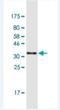 Zinc Finger Protein 134 antibody, H00007693-M03-100ug, Novus Biologicals, Western Blot image 