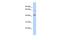 Solute Carrier Family 22 Member 12 antibody, PA5-42510, Invitrogen Antibodies, Western Blot image 