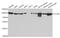 Chloride Voltage-Gated Channel 5 antibody, PA5-76761, Invitrogen Antibodies, Western Blot image 