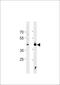 Heat Shock Transcription Factor 1 antibody, MBS9211638, MyBioSource, Western Blot image 