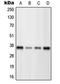 POU Class 4 Homeobox 3 antibody, LS-C352685, Lifespan Biosciences, Western Blot image 