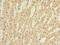 Zinc Finger And BTB Domain Containing 20 antibody, LS-C676727, Lifespan Biosciences, Immunohistochemistry paraffin image 