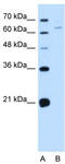 NADPH Oxidase 1 antibody, TA341879, Origene, Western Blot image 