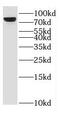 Epithelial Splicing Regulatory Protein 2 antibody, FNab02870, FineTest, Western Blot image 