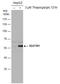 Sequestosome 1 antibody, GTX111393, GeneTex, Western Blot image 