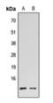 High Mobility Group Nucleosomal Binding Domain 2 antibody, orb393317, Biorbyt, Western Blot image 