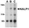 NLR Family Pyrin Domain Containing 1 antibody, TA306106, Origene, Western Blot image 