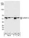 Heterogeneous nuclear ribonucleoprotein K antibody, A300-678A, Bethyl Labs, Western Blot image 