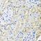 Heterogeneous Nuclear Ribonucleoprotein L antibody, GTX65923, GeneTex, Immunohistochemistry paraffin image 