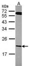 Regulator Of G Protein Signaling 10 antibody, TA308469, Origene, Western Blot image 