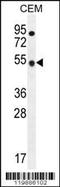 TBC1 Domain Family Member 13 antibody, TA324444, Origene, Western Blot image 