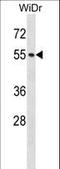 Nuclear pore complex protein Nup50 antibody, LS-C163074, Lifespan Biosciences, Western Blot image 