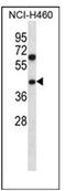 Pseudouridine Synthase 1 antibody, AP53521PU-N, Origene, Western Blot image 