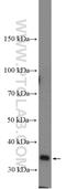 Tumor Suppressor Candidate 3 antibody, 16039-1-AP, Proteintech Group, Western Blot image 