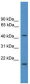 Saccharopine Dehydrogenase (Putative) antibody, TA335576, Origene, Western Blot image 