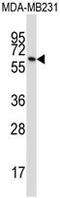 Butyrophilin Subfamily 3 Member A1 antibody, GTX53488, GeneTex, Western Blot image 