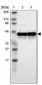 ILK Associated Serine/Threonine Phosphatase antibody, PA5-52100, Invitrogen Antibodies, Western Blot image 