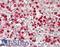 Proteinase 3 antibody, LS-B13290, Lifespan Biosciences, Immunohistochemistry paraffin image 