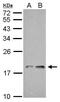 NADH:Ubiquinone Oxidoreductase Subunit AB1 antibody, TA308227, Origene, Western Blot image 