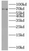 POF1B Actin Binding Protein antibody, FNab06601, FineTest, Western Blot image 