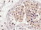 Solute Carrier Family 22 Member 16 antibody, LS-C55473, Lifespan Biosciences, Immunohistochemistry frozen image 