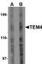 Rho Guanine Nucleotide Exchange Factor 17 antibody, AP22665PU-N, Origene, Western Blot image 