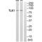 Tousled Like Kinase 1 antibody, A05635-1, Boster Biological Technology, Western Blot image 