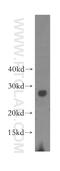 Charged Multivesicular Body Protein 3 antibody, 15472-1-AP, Proteintech Group, Western Blot image 