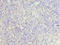 Charged multivesicular body protein 2b antibody, LS-C675525, Lifespan Biosciences, Immunohistochemistry paraffin image 