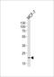 Nitric Oxide Synthase 1 Adaptor Protein antibody, 55-115, ProSci, Western Blot image 