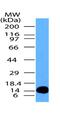 Mitochondrial E3 Ubiquitin Protein Ligase 1 antibody, NBP2-31361, Novus Biologicals, Western Blot image 