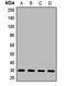 Polyglutamine Binding Protein 1 antibody, LS-C668596, Lifespan Biosciences, Western Blot image 