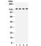 Solute Carrier Family 12 Member 1 antibody, R32222, NSJ Bioreagents, Western Blot image 