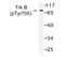 BDNF/NT-3 growth factors receptor antibody, AP01712PU-N, Origene, Western Blot image 