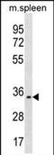 Triggering Receptor Expressed On Myeloid Cells Like 1 antibody, PA5-72082, Invitrogen Antibodies, Western Blot image 