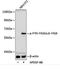 FYN Proto-Oncogene, Src Family Tyrosine Kinase antibody, MBS9128730, MyBioSource, Western Blot image 