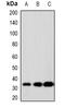 Synaptonemal Complex Protein 3 antibody, orb382558, Biorbyt, Western Blot image 