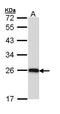 Complement C1q A Chain antibody, PA5-29586, Invitrogen Antibodies, Western Blot image 