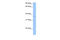 TREML2 antibody, ARP49878_P050, Aviva Systems Biology, Western Blot image 