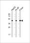 Adenosine Kinase antibody, M02193-1, Boster Biological Technology, Western Blot image 