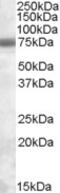 Apolipoprotein B MRNA Editing Enzyme Catalytic Subunit 3G antibody, 46-731, ProSci, Western Blot image 